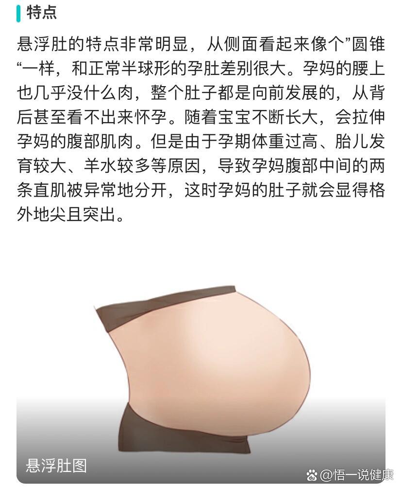 悬浮肚顺产概率大不大😭