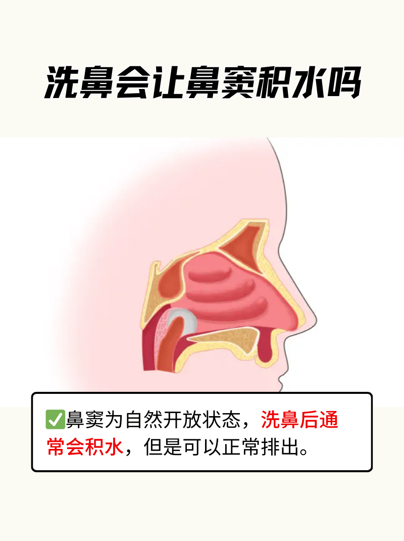 鼻窦积液排出姿势图片