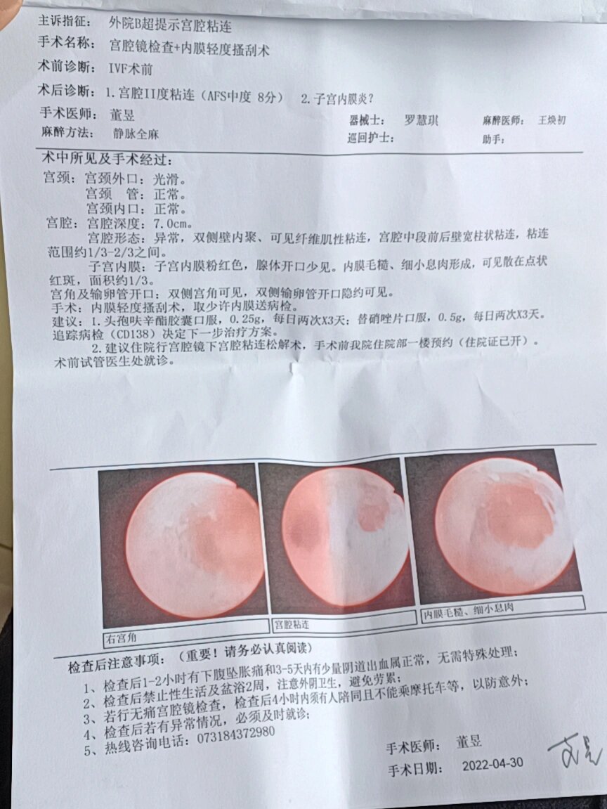 宫腔粘连中度8分