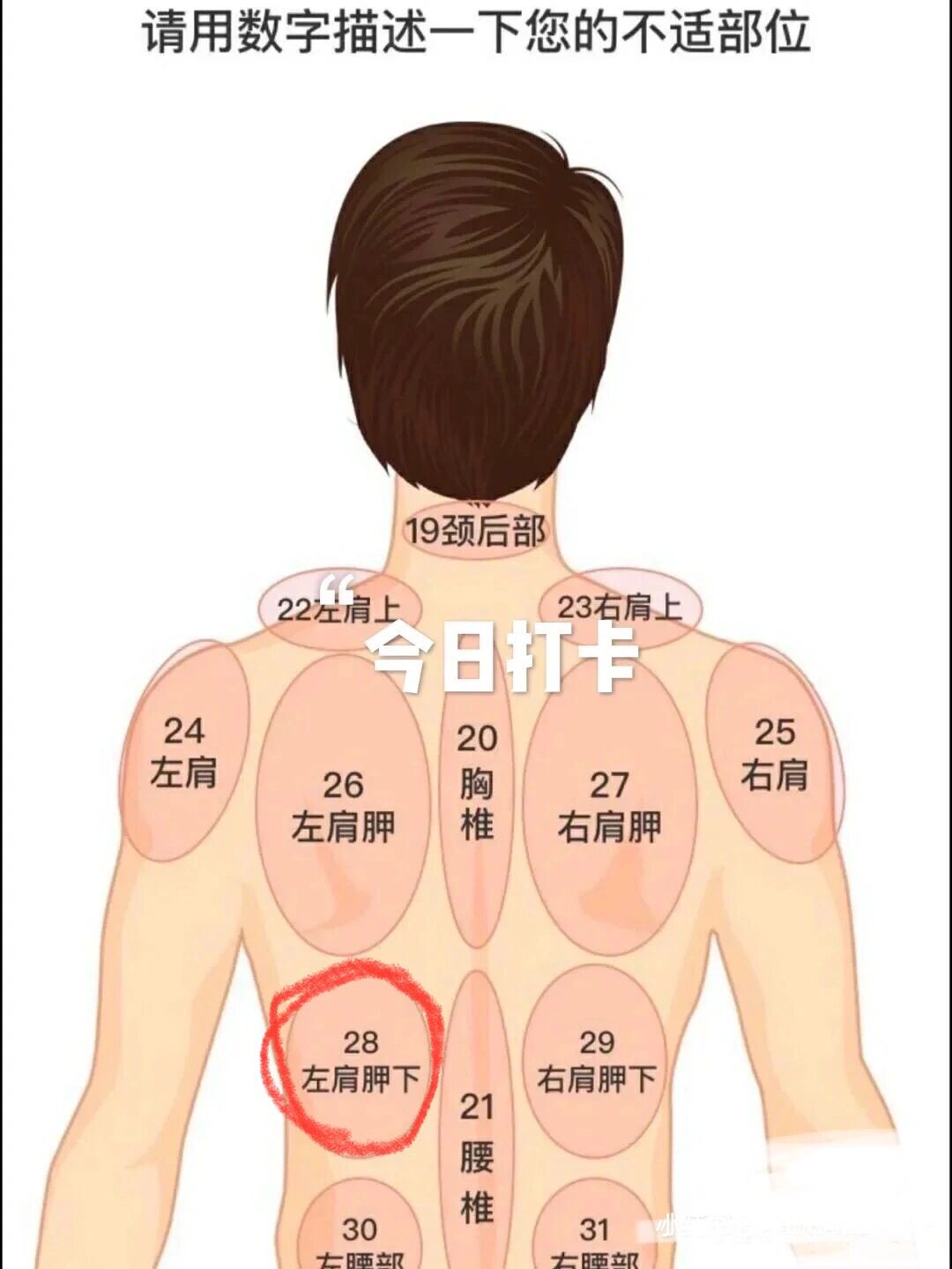 腰背肌筋膜炎 关于莫名背痛