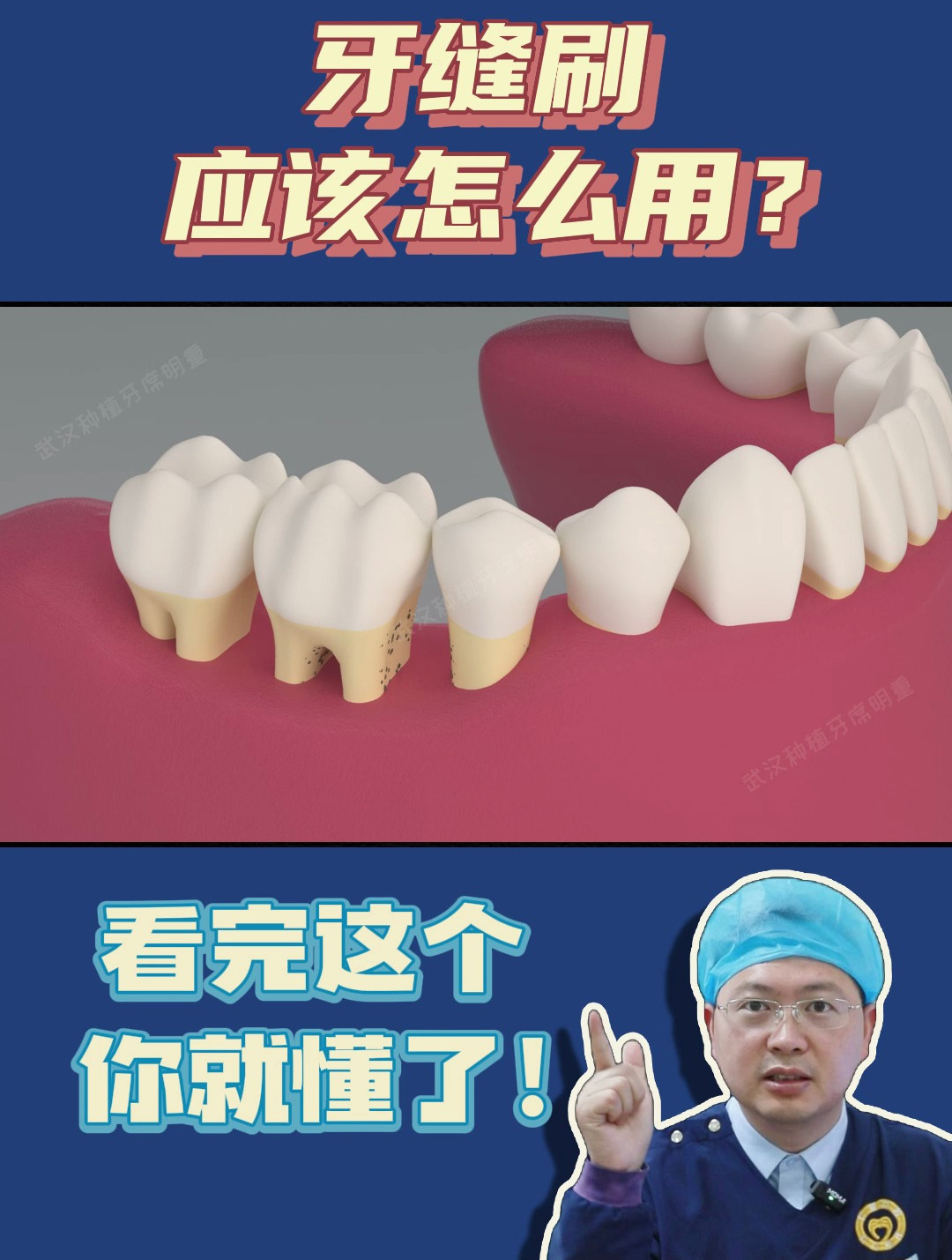 牙缝刷的使用方法!看完就会了