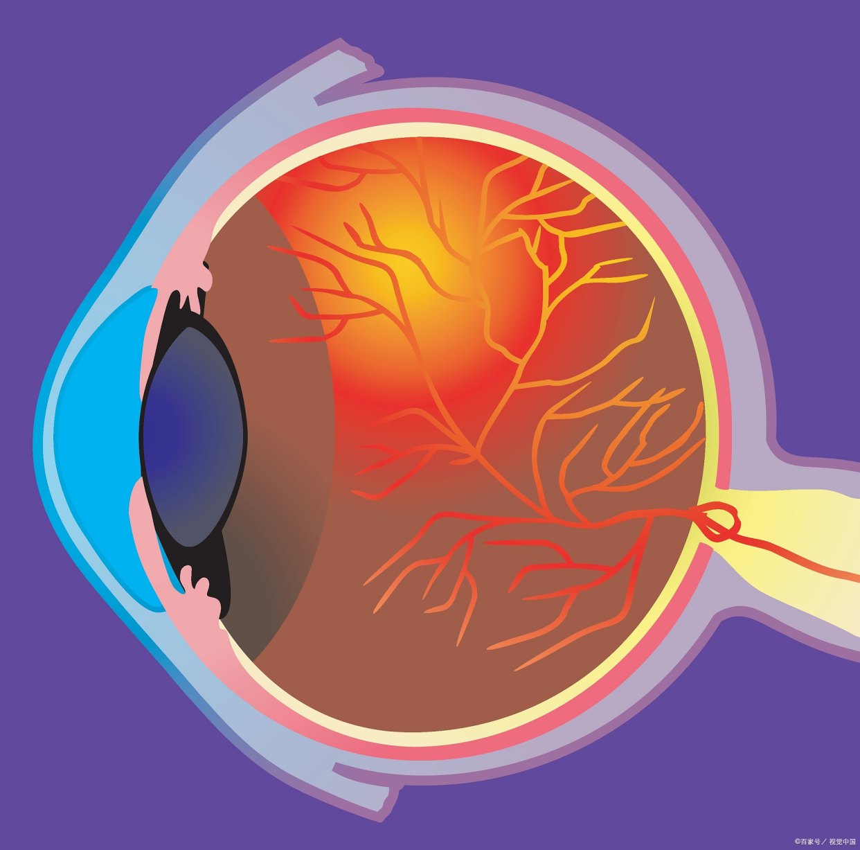 糖尿病性视网膜病变(Diabetic Retinopathy)