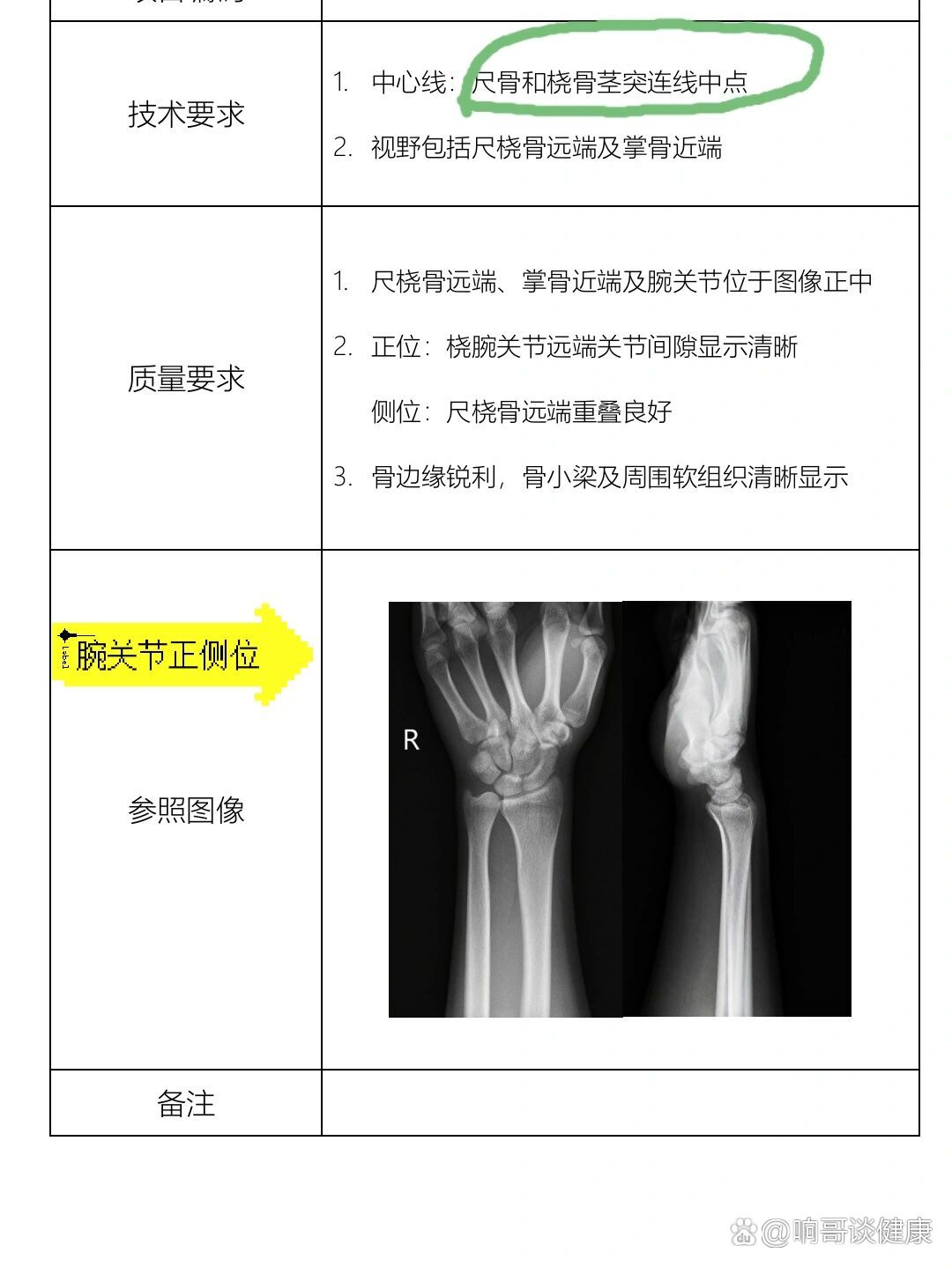 腕关节正侧位怎么拍图片