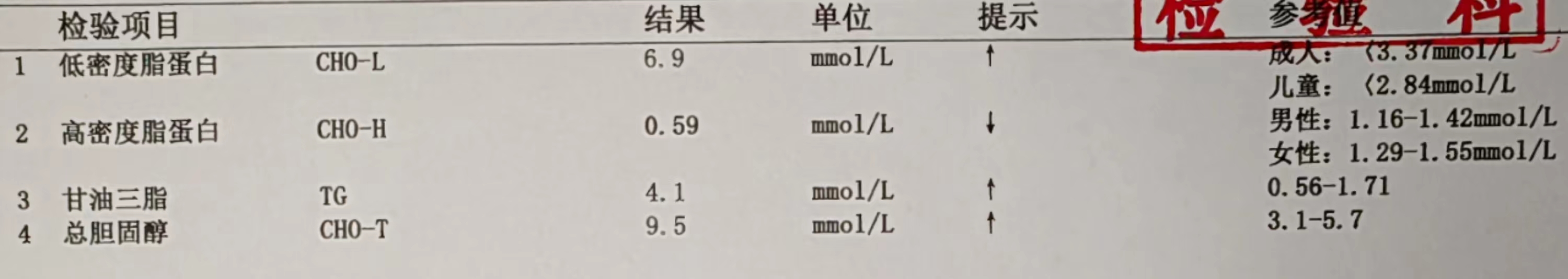 脑袋昏昏沉沉,小心混合性高脂血症