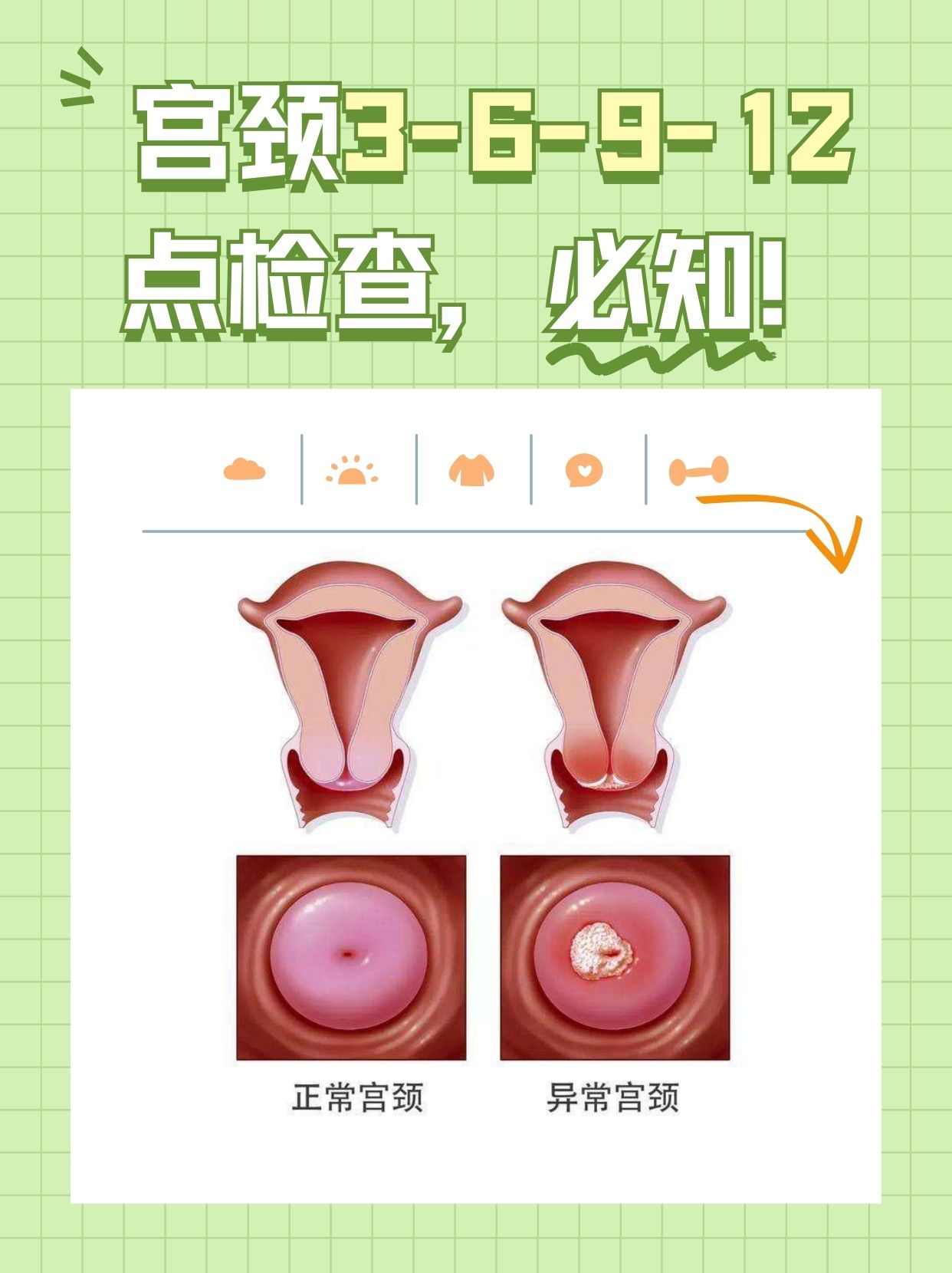 宫颈3-6-9-12点检查,必知!