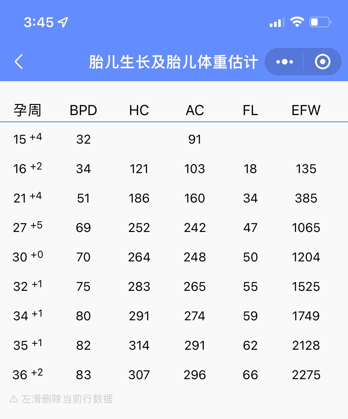 孕34周胎儿图片