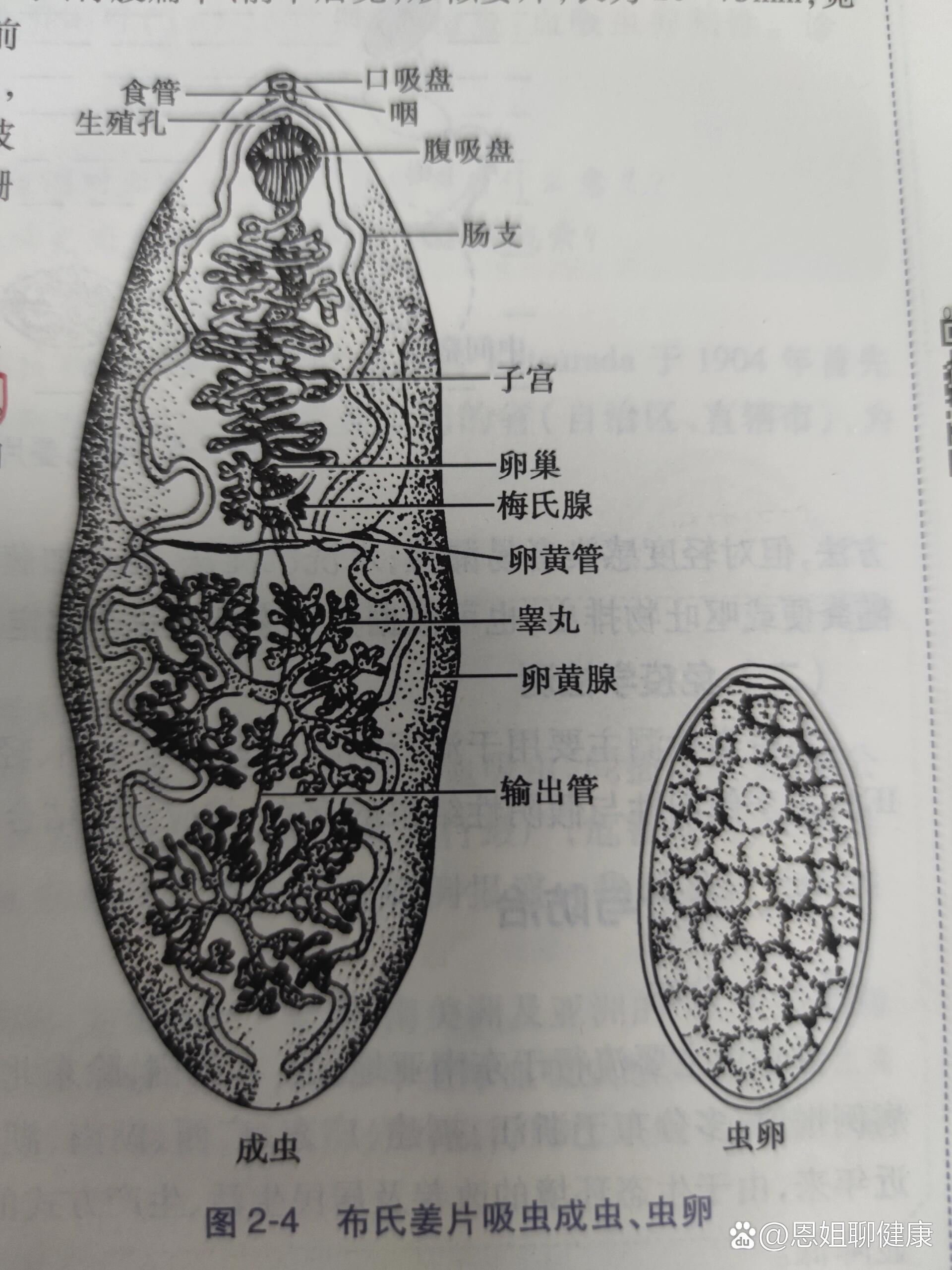 布氏姜片吸虫虫卵手绘图片