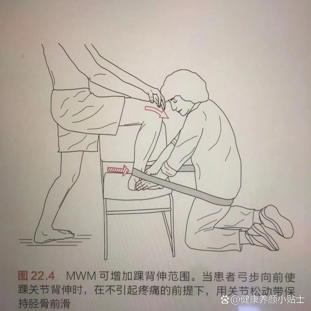 腕背屈角度图片