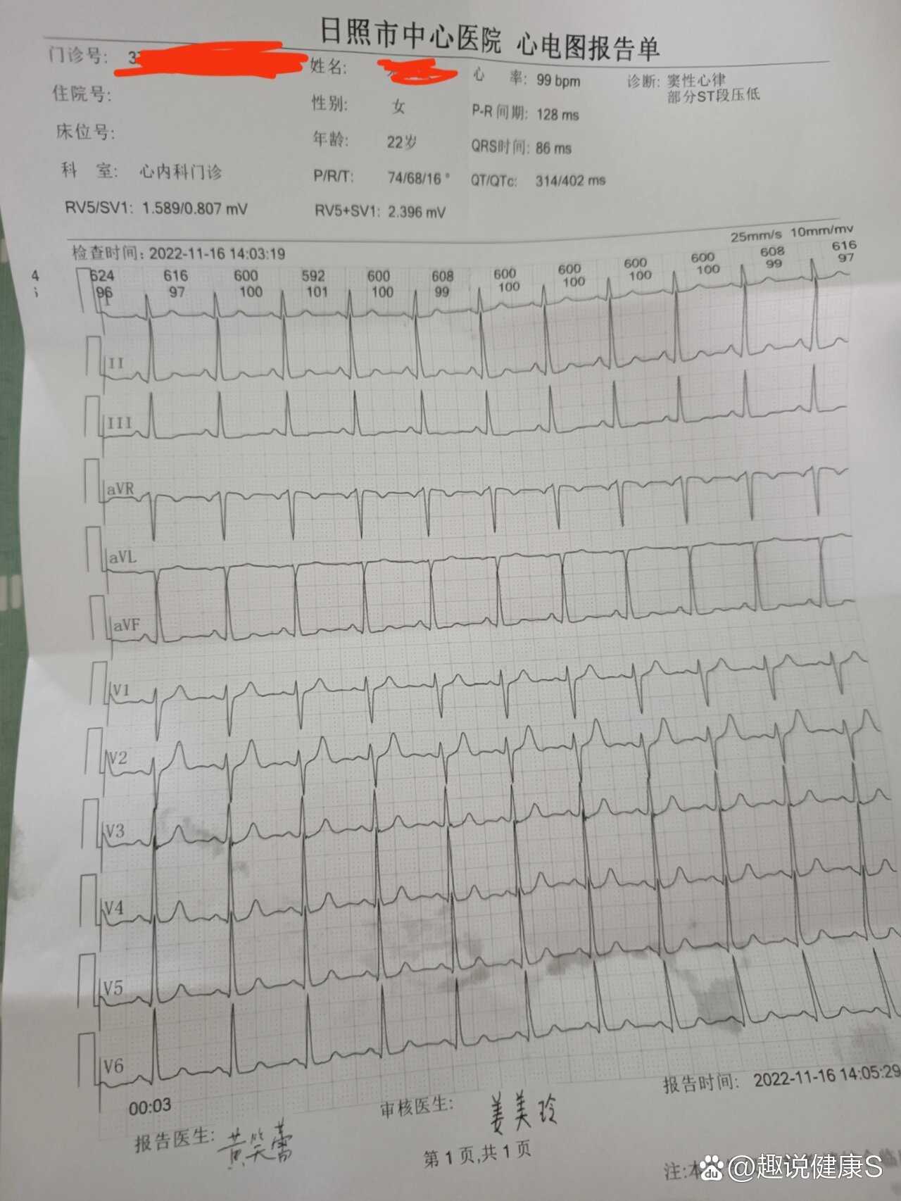 心律不齐 单子图片