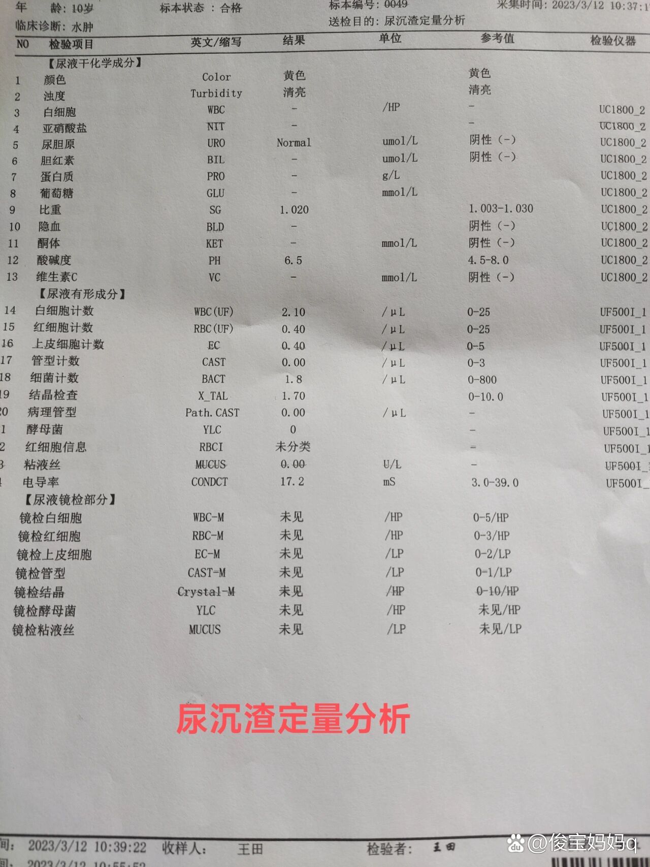 孩子晨尿有泡沫图片图片