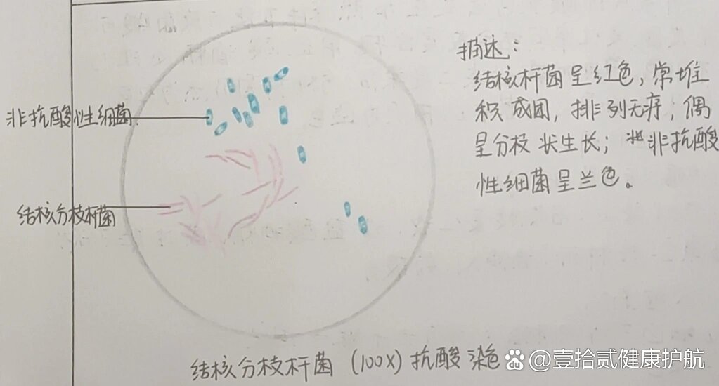 结核分枝杆菌手绘图片图片