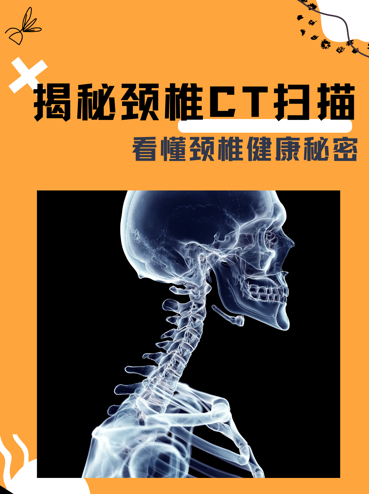 揭秘颈椎ct扫描:看懂颈椎健康秘密