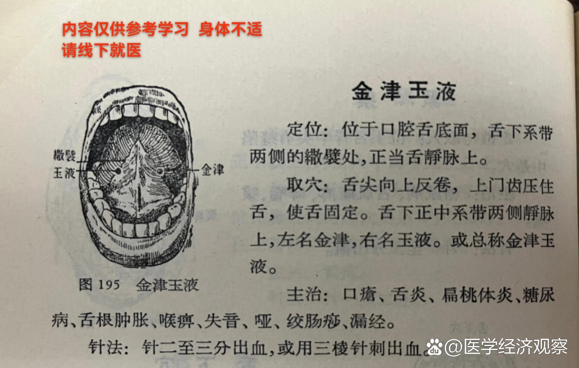  p>经外奇穴 口部 金津玉液 定位 取穴 主治 br>内容仅供参考学习