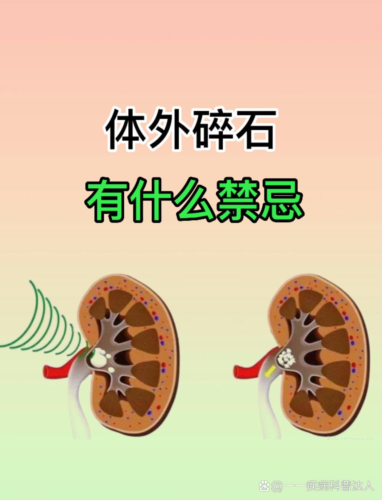 体外碎石广告图片