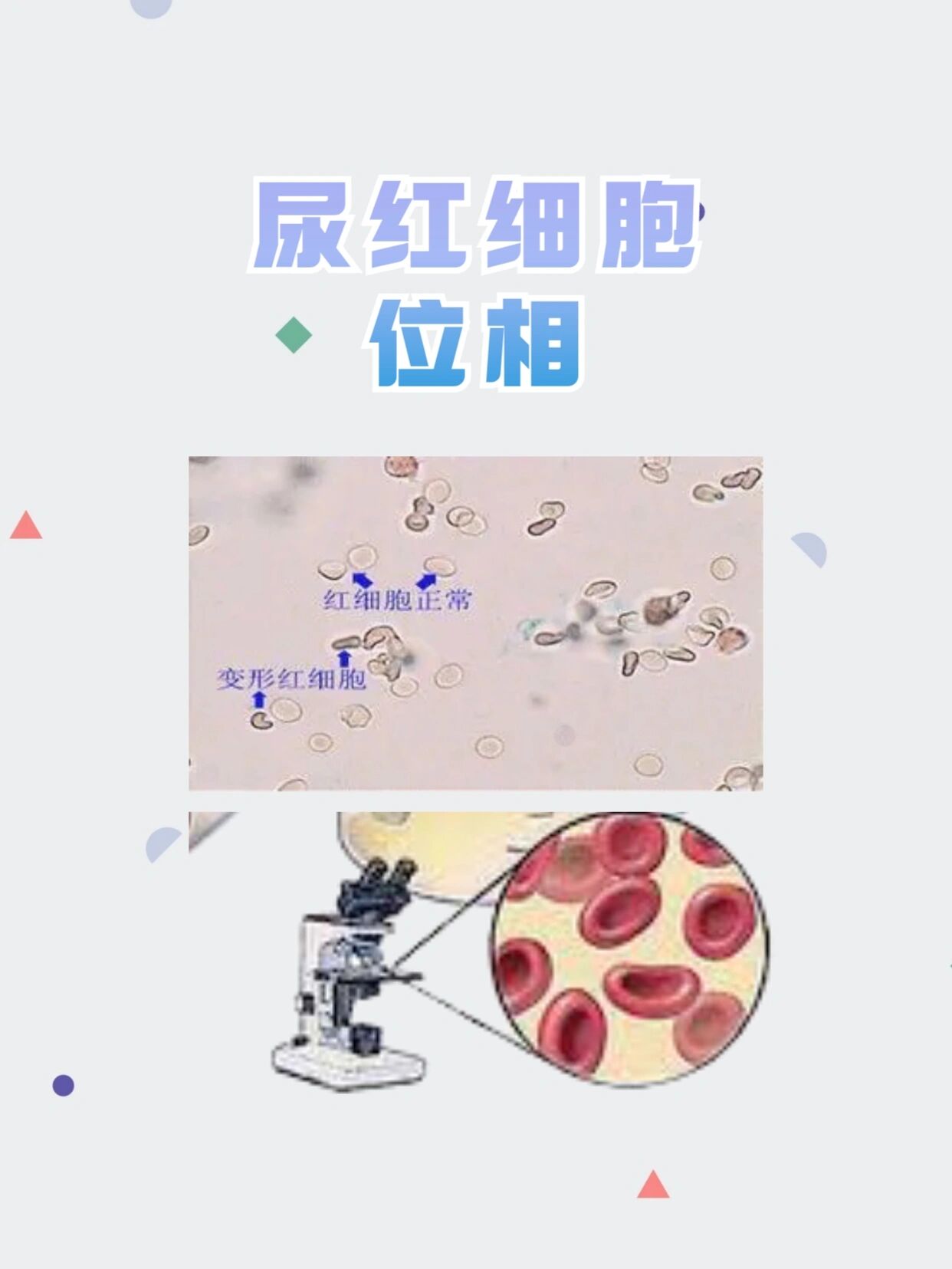 尿红细胞位相正常值图片