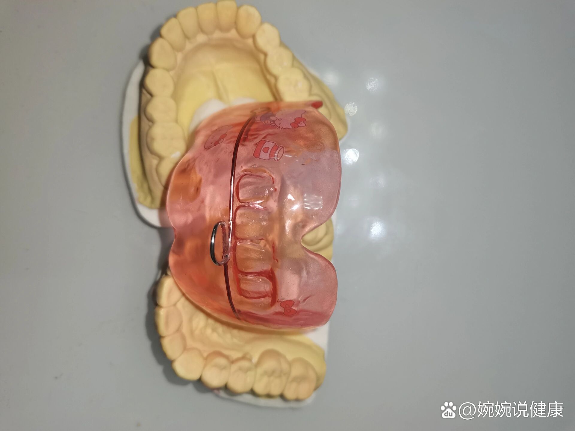 【不良习惯系列】前庭盾矫治器6015