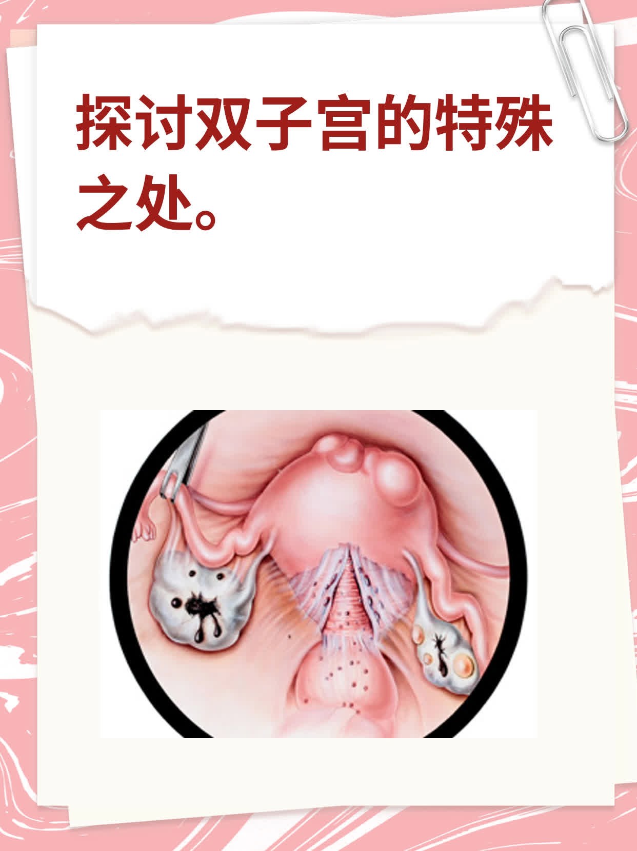 探讨双子宫的特殊之处