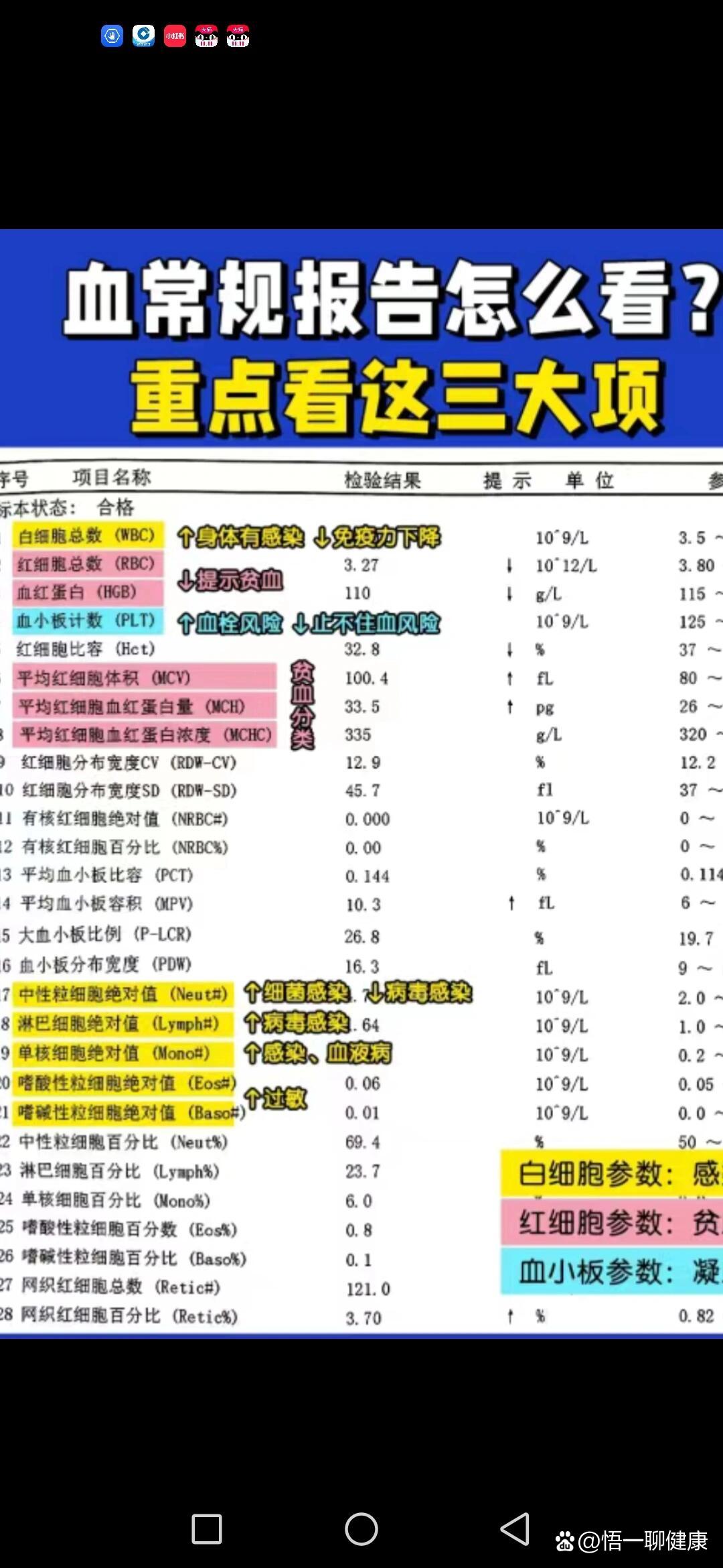 干燥综合症诊断标准