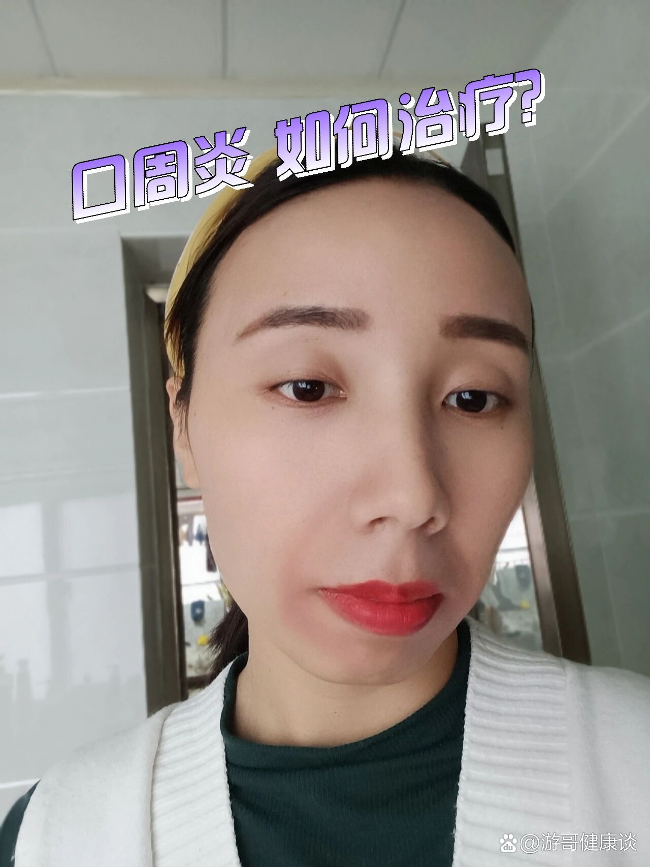 口周炎如何治疗