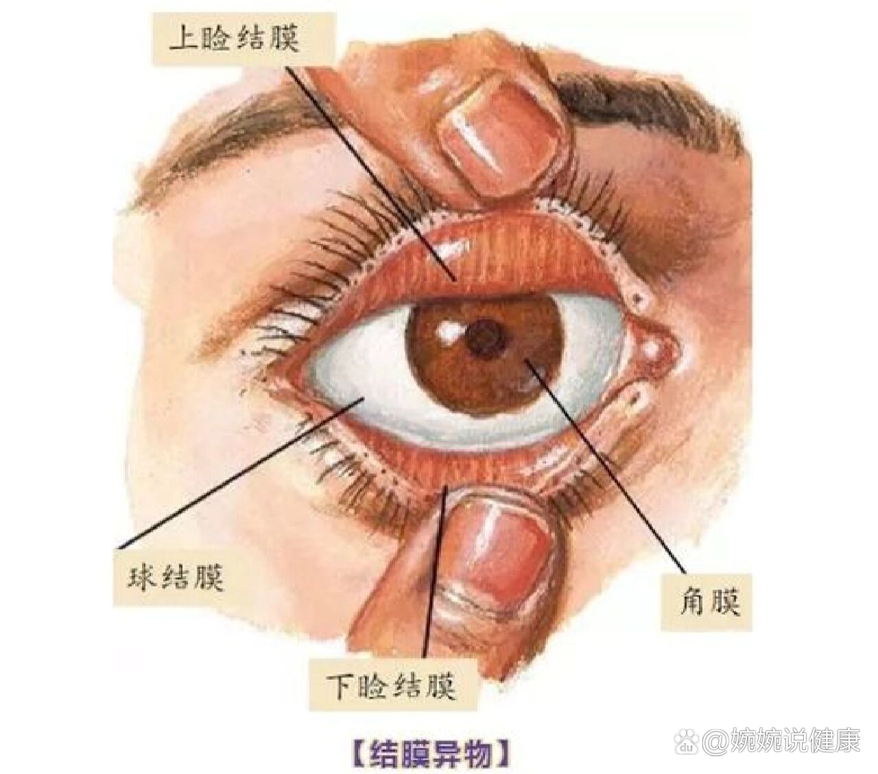 眼睑的裂缝称为睑裂