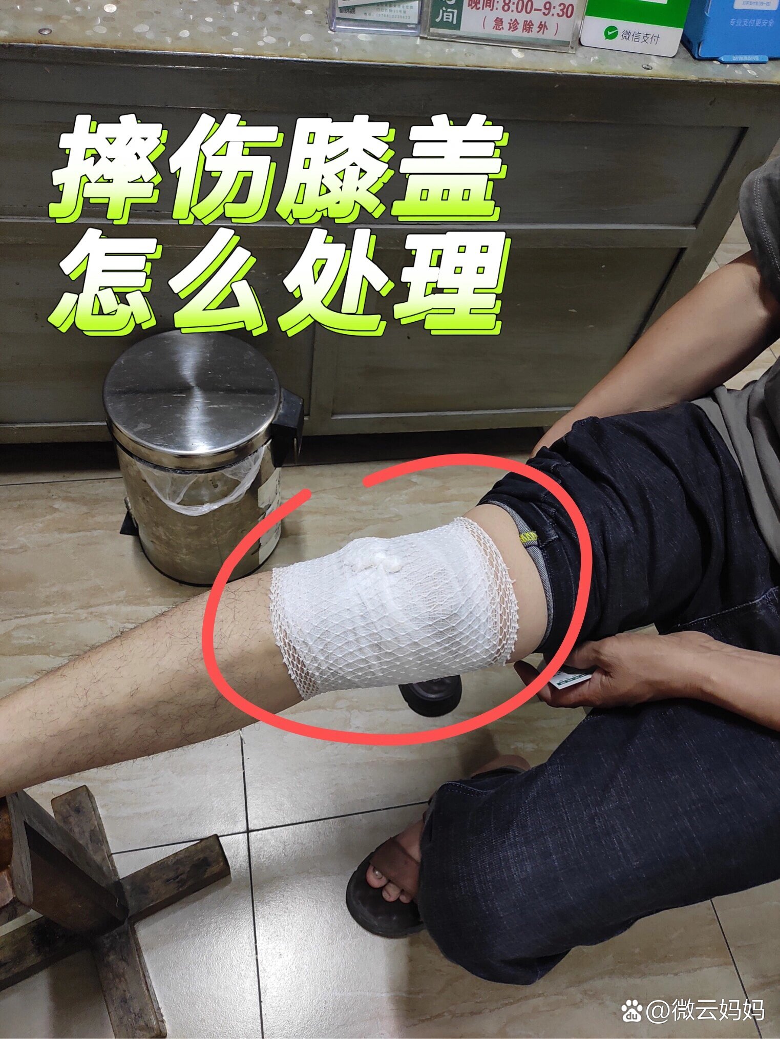 我膝盖摔伤了怎么处理