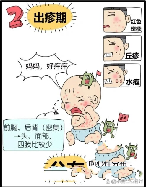 痱子和水痘的区别图片