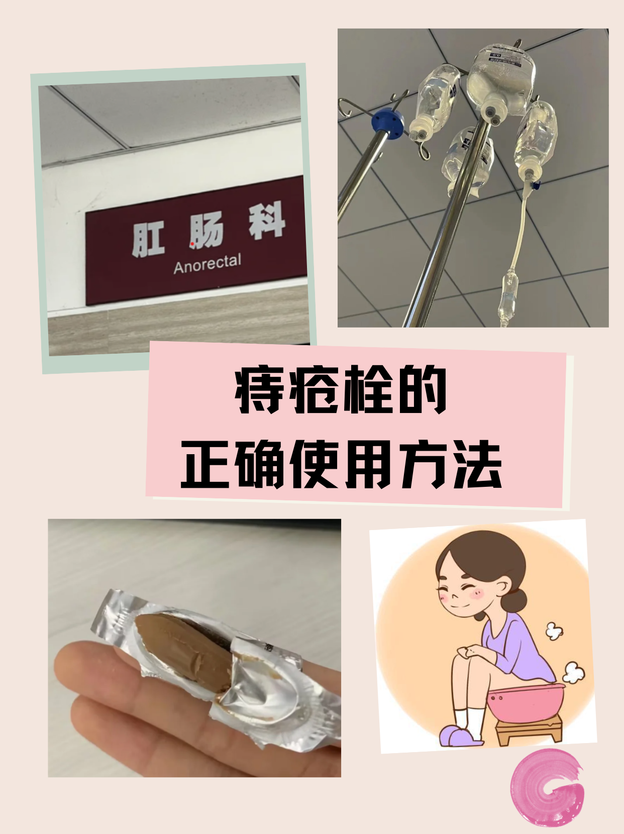 化痔栓使用方法和图片图片