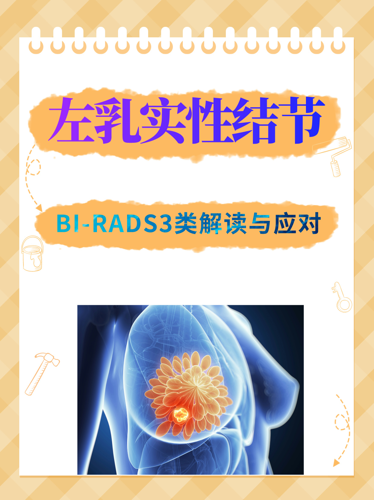 乳腺结节4c图片