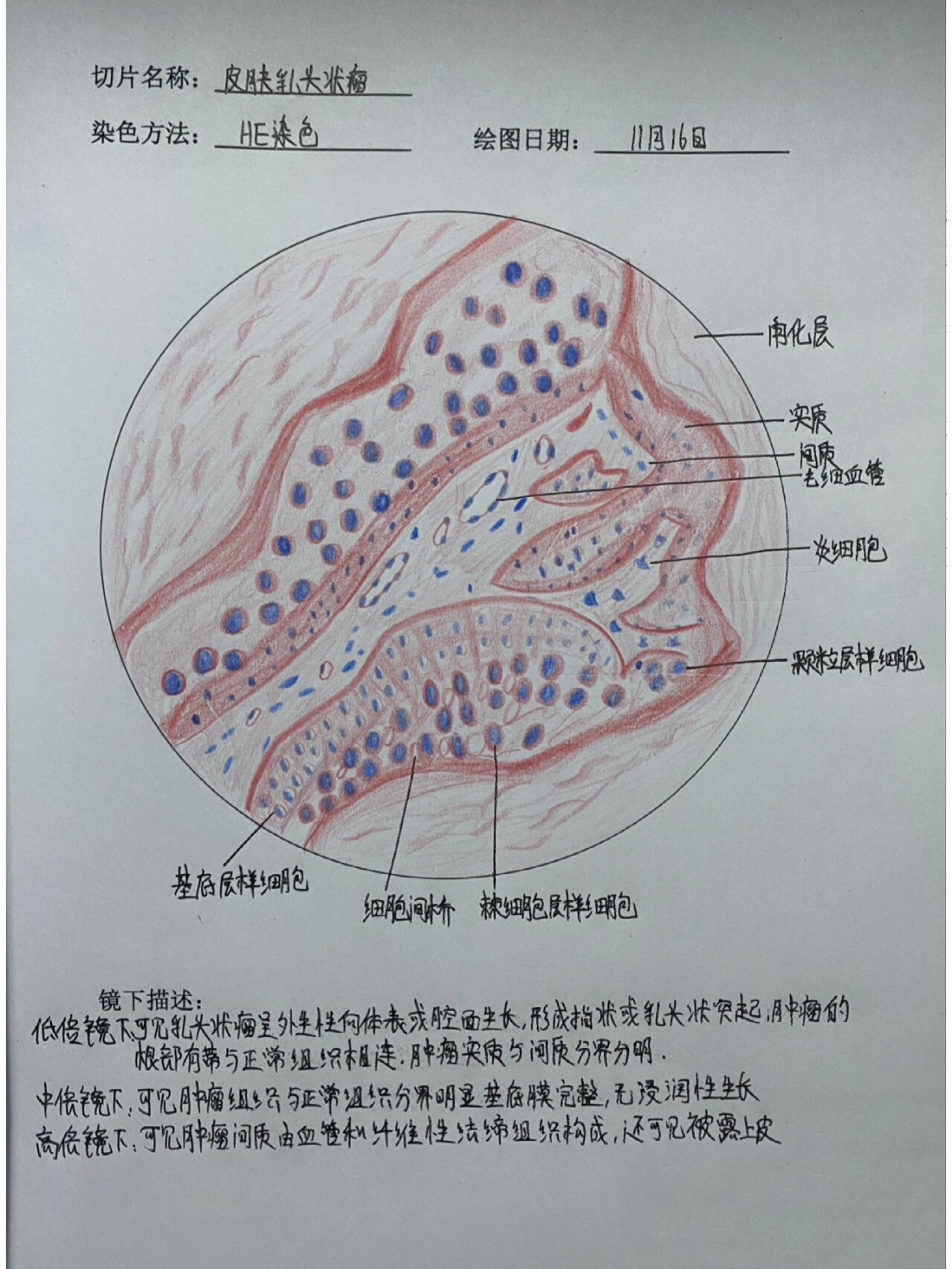 乳腺癌红蓝铅笔绘图图片