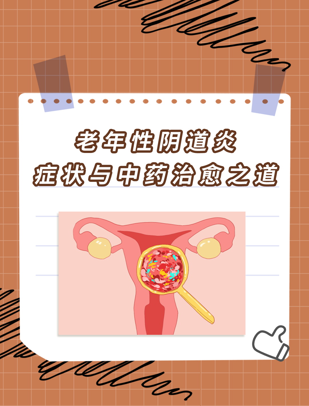 老年性阴炎知多少?中药方助力摆脱困扰