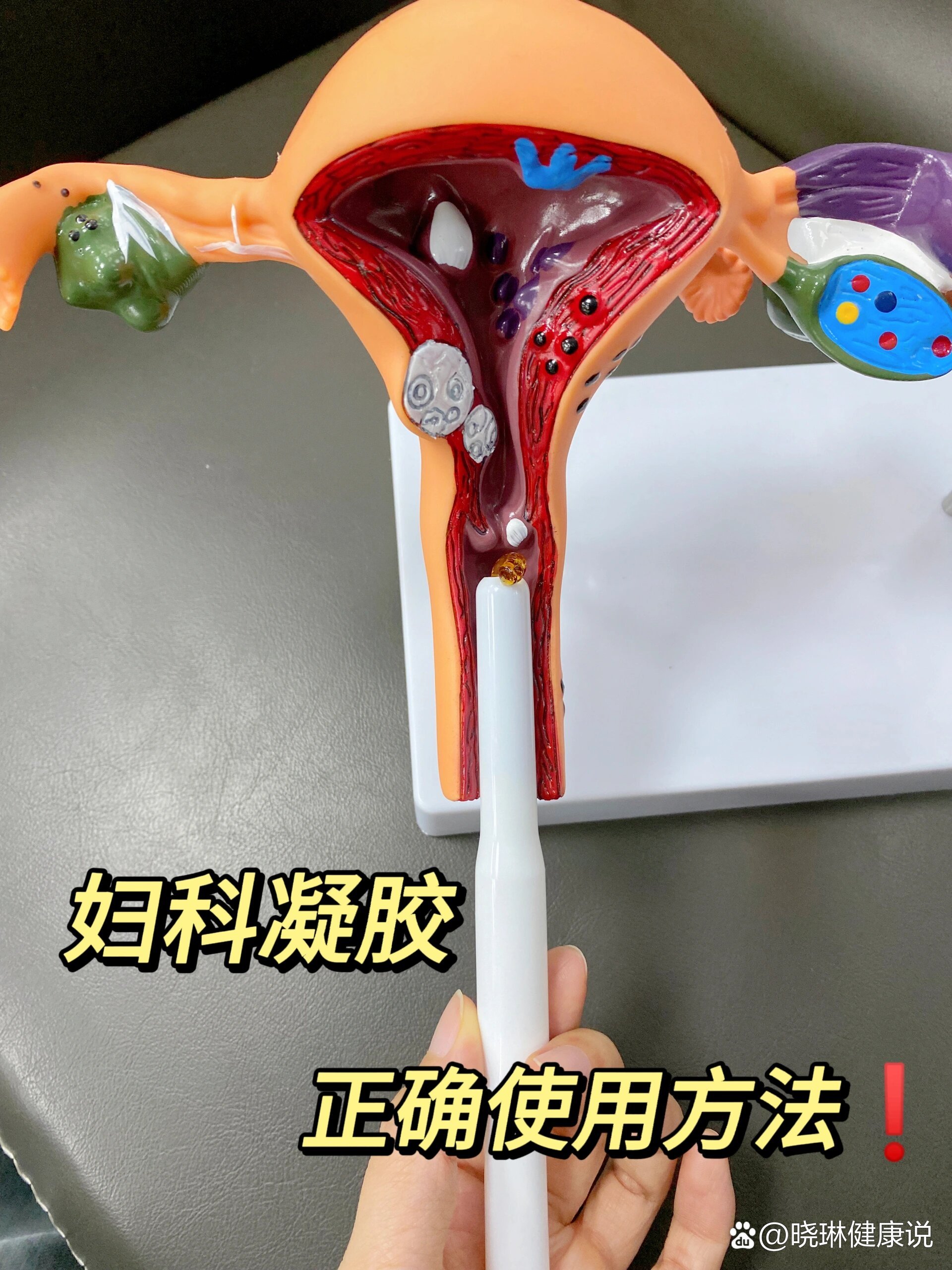 正常月经 腐肉图片