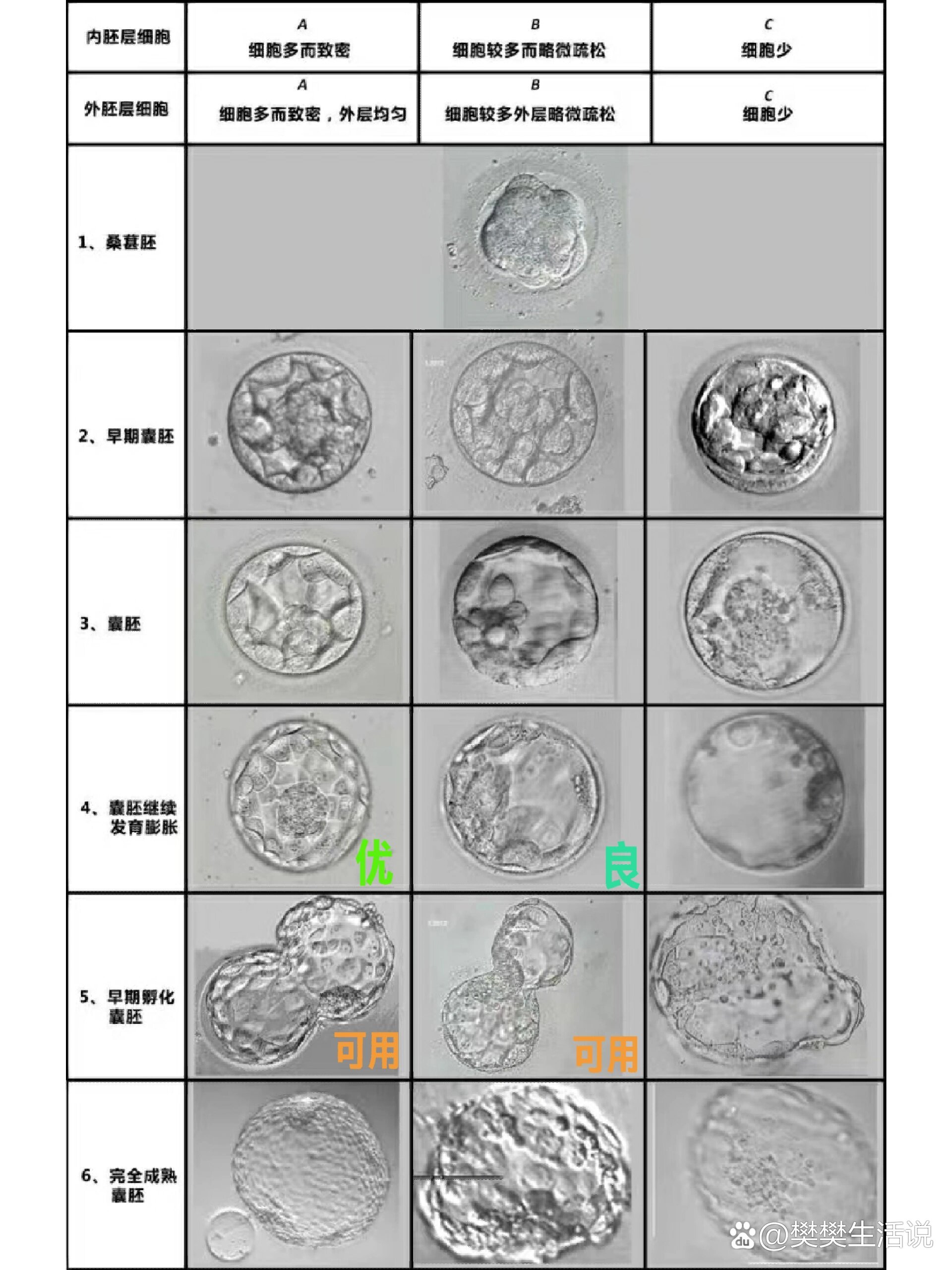 囊胚级别顺序图片