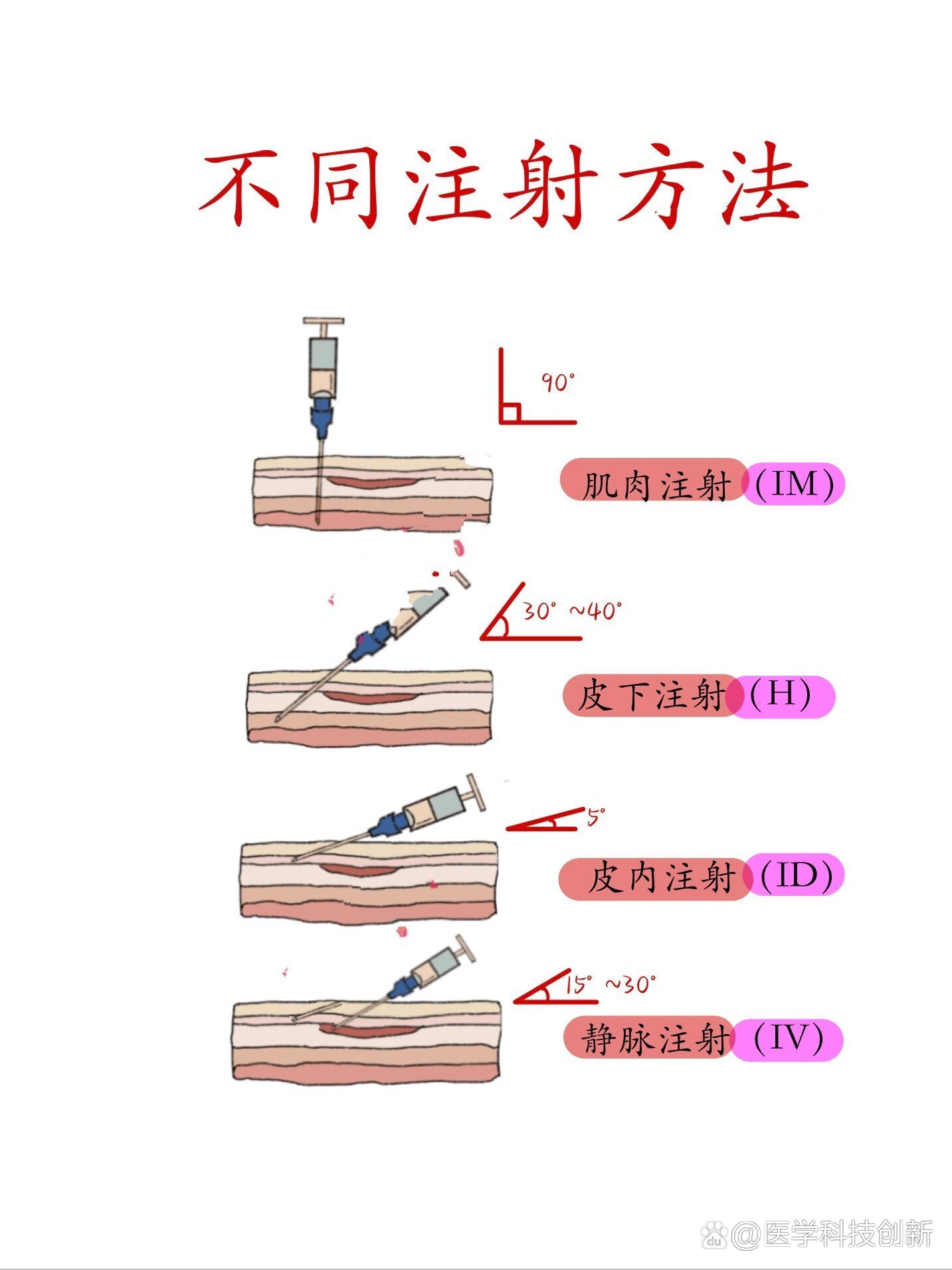 br 皮下注射