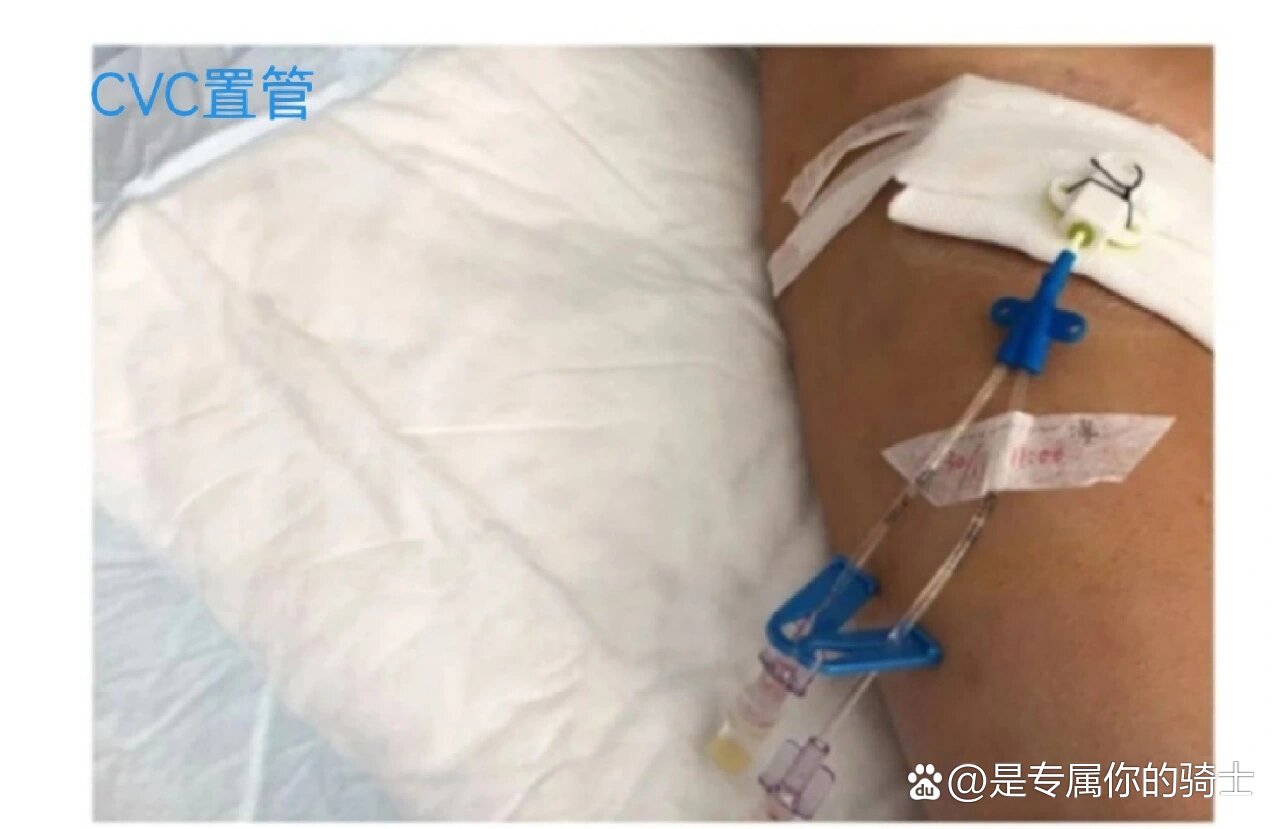 四大导管