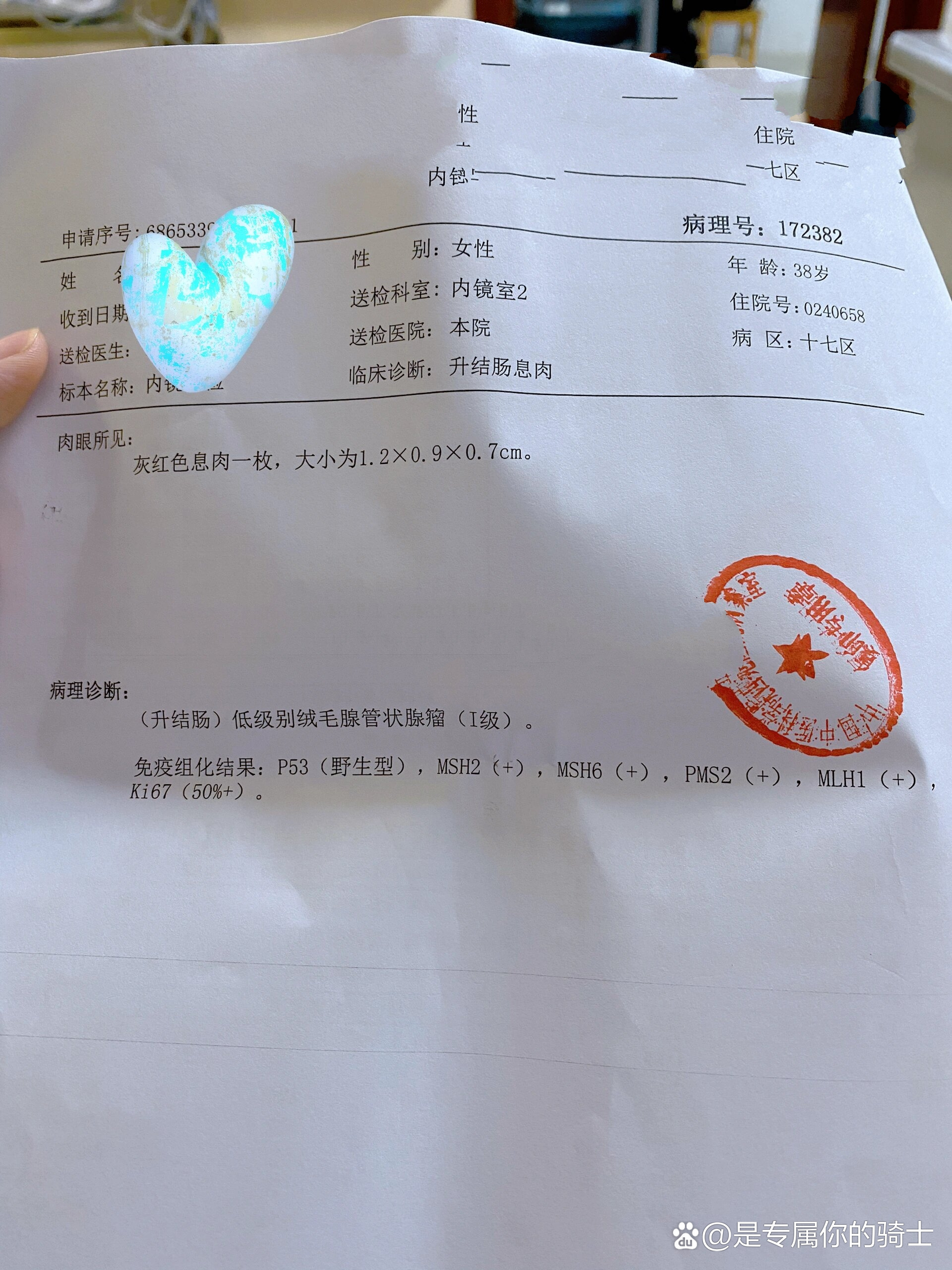  br>今天去打印了肠息肉的病理报告,虽然大夫说要有问题就给你打