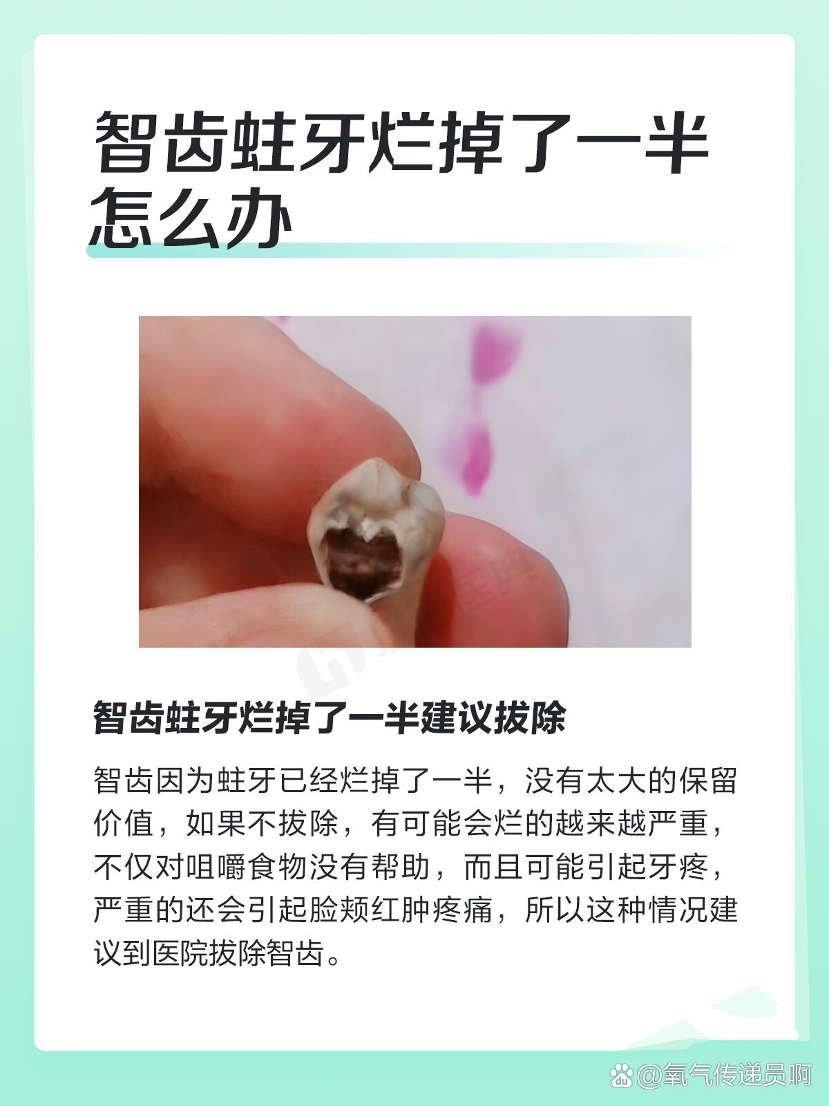 智齿蛀牙烂掉了一半怎么办?