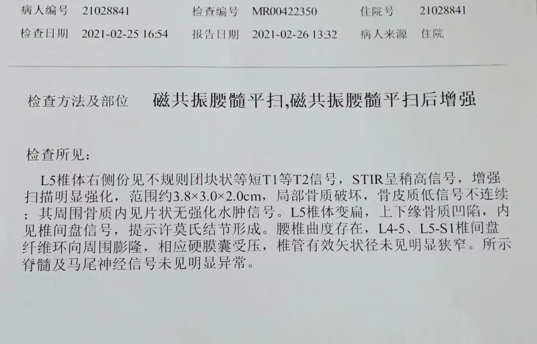 骨母细胞瘤不用怕