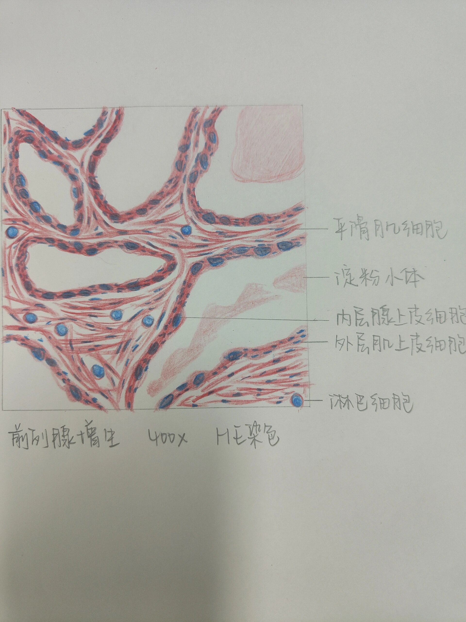 乙脑病理红蓝铅笔图图片