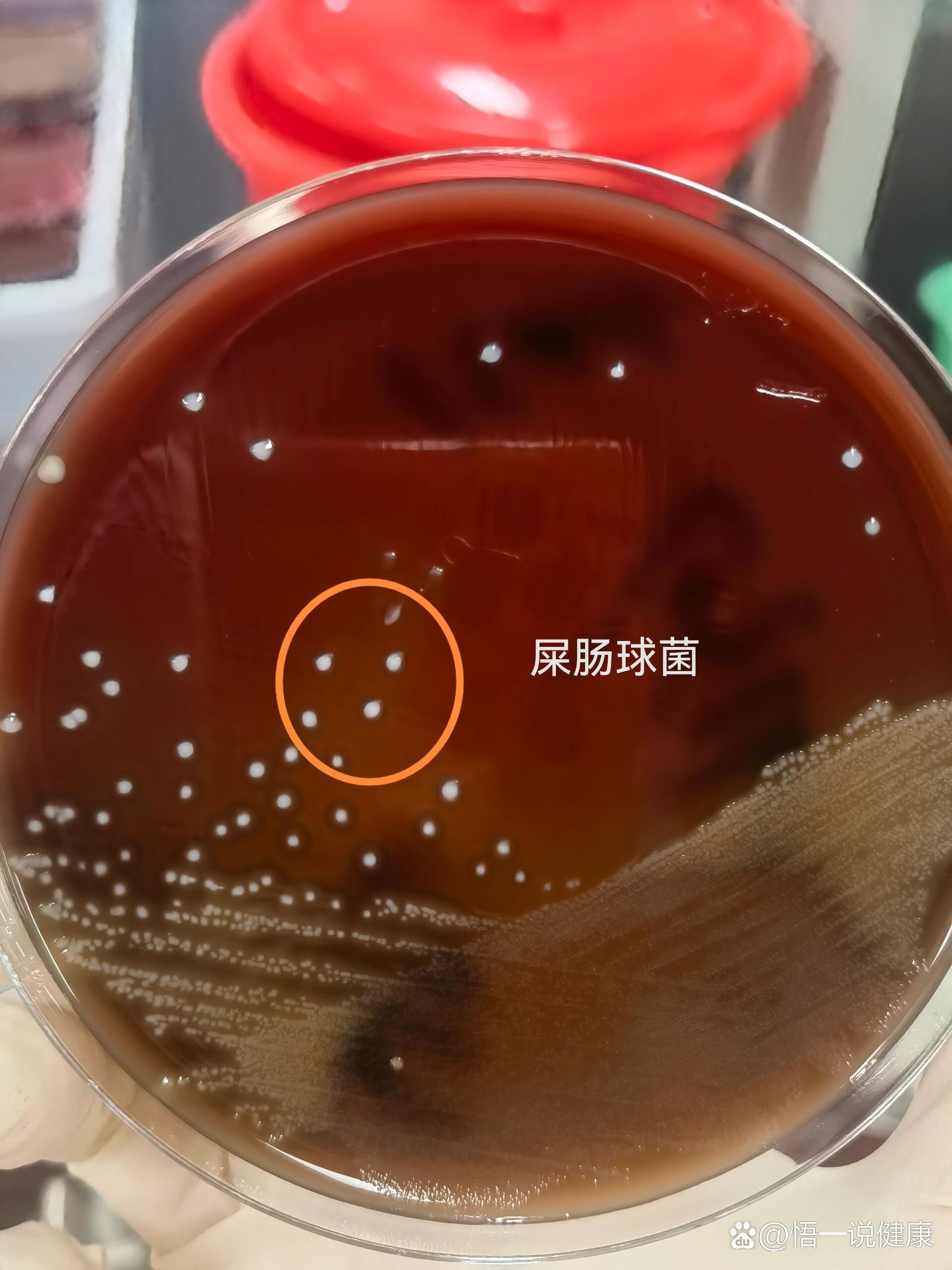 肠球菌两种肠球菌屎肠球菌有一圈黑色的环而粪肠球菌没有