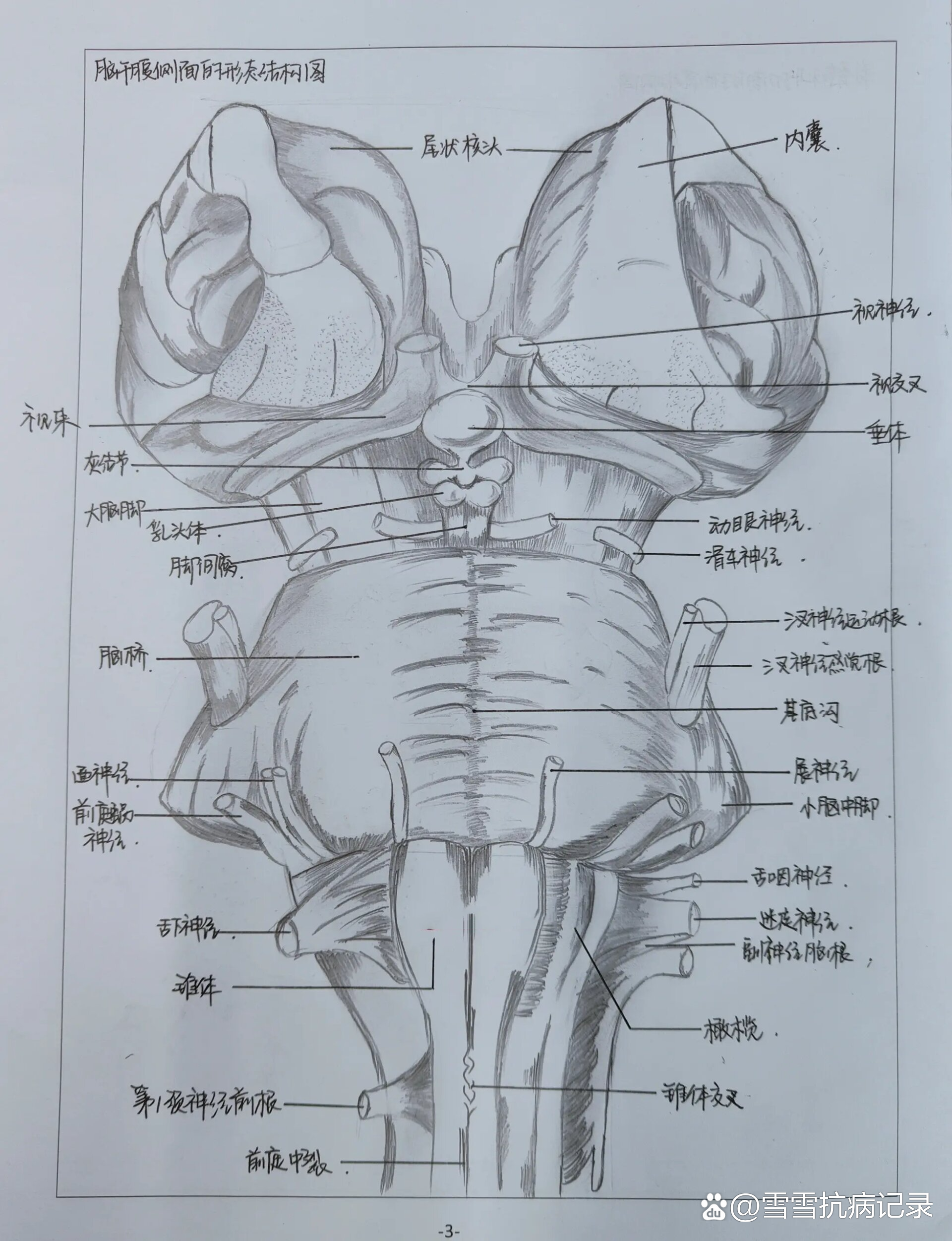 脑干腹侧面观图片