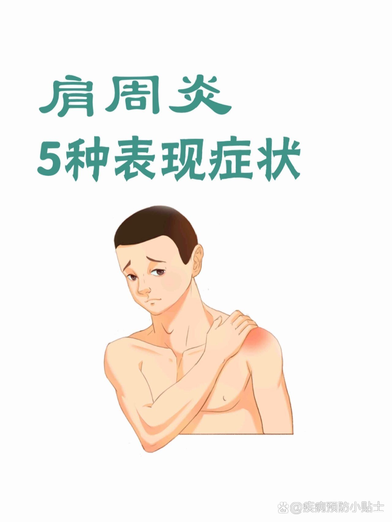 肩周炎的5大症状表现