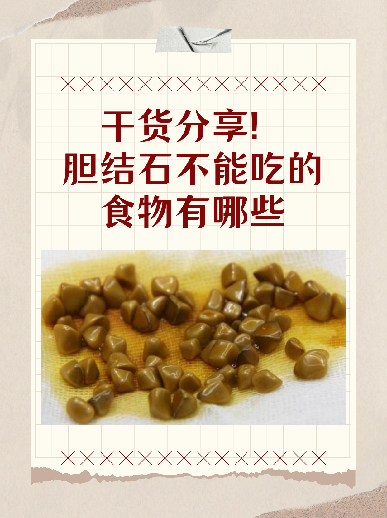 胆结石禁忌食物图片