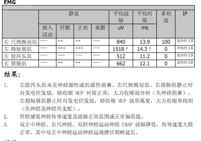 腓肠神经肌电图图片