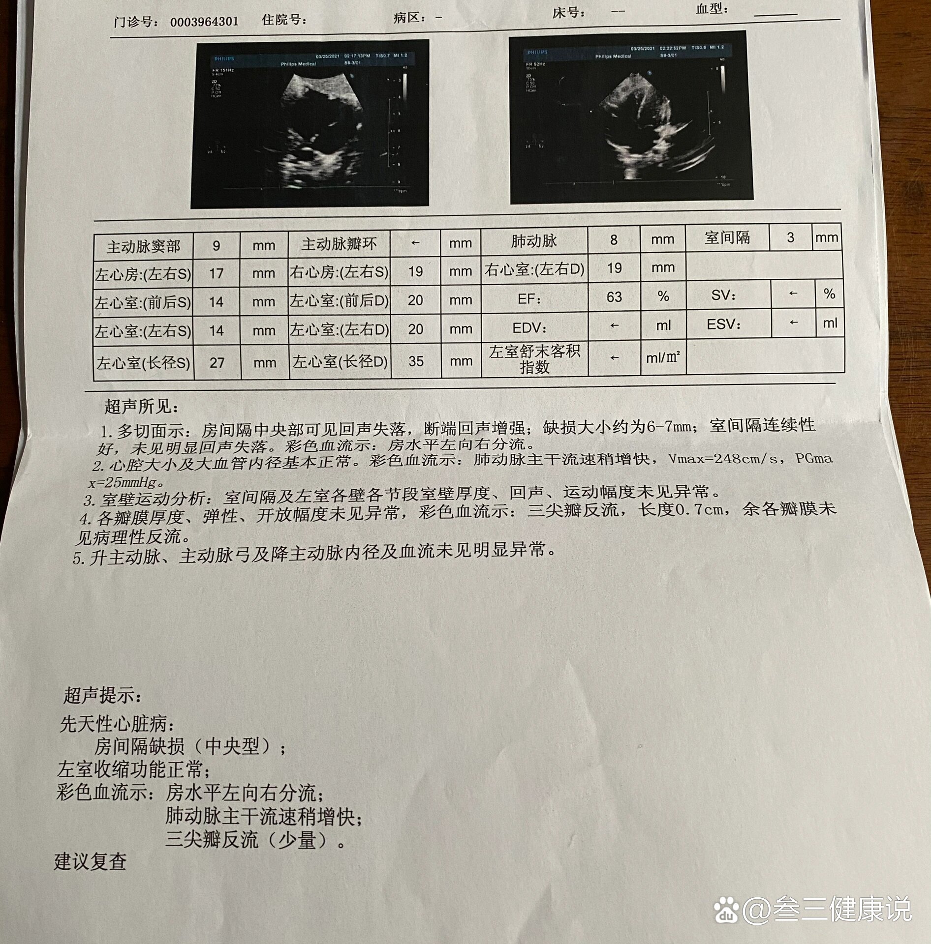房间隔缺损7mm自愈