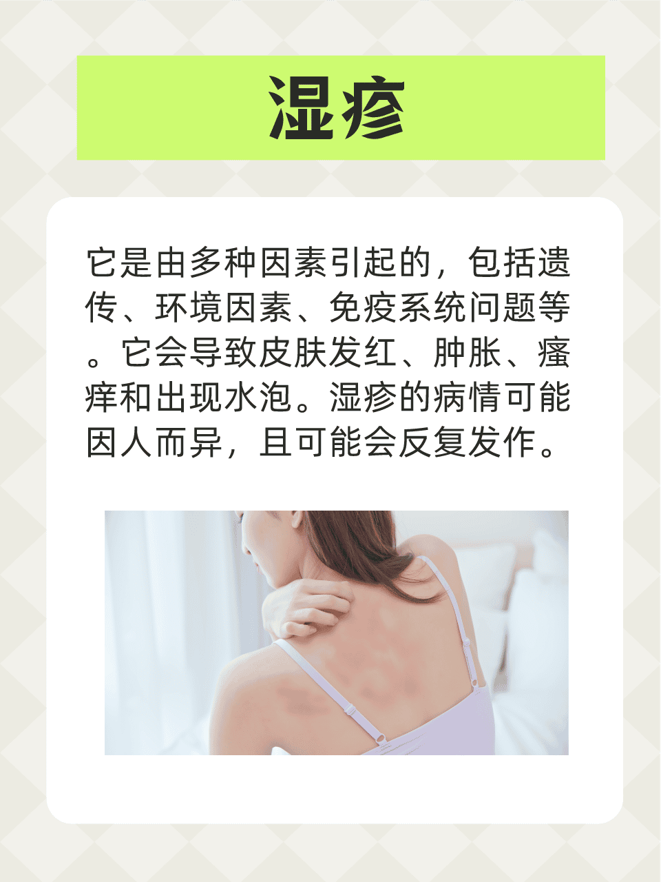 神经性皮炎会传染么图片