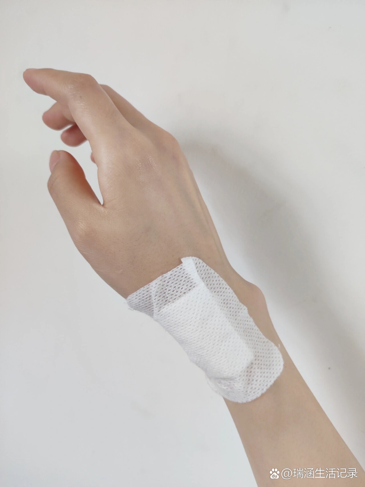 "妈妈手"腱鞘炎小针刀