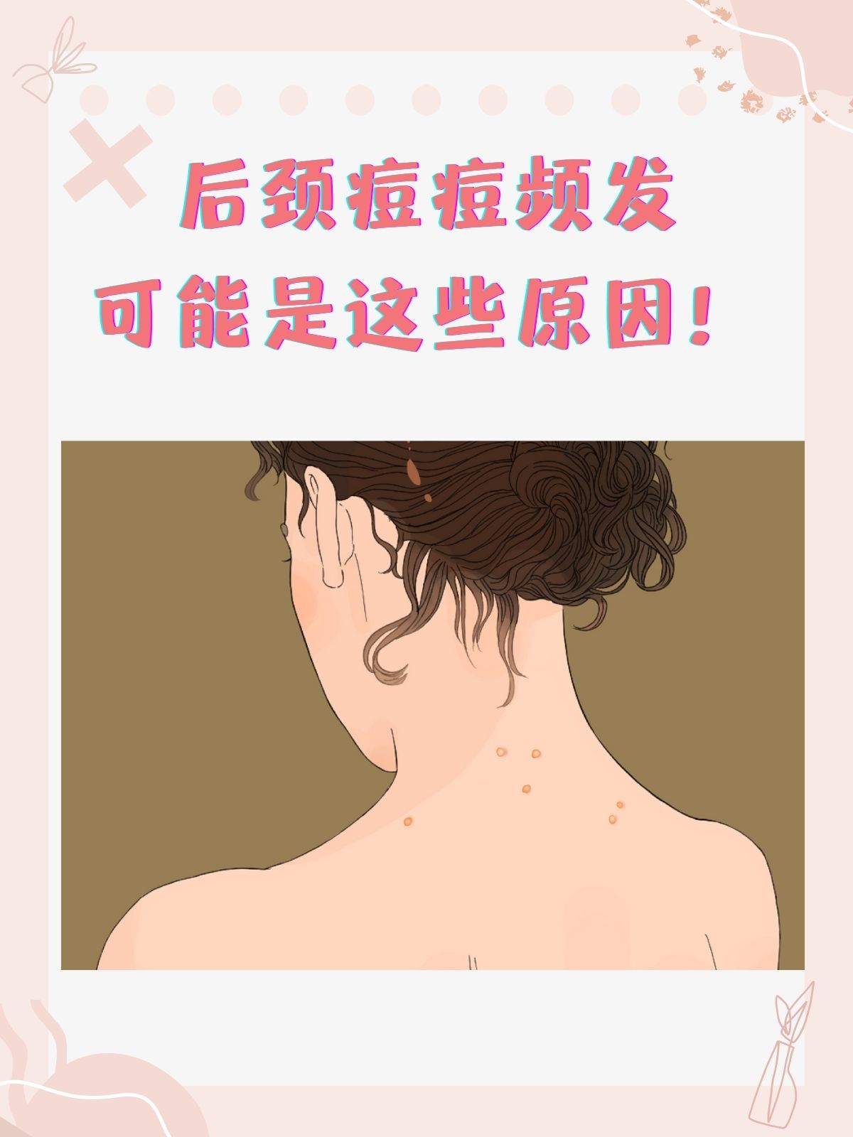 脖子后痘痘频发,原因需留心!