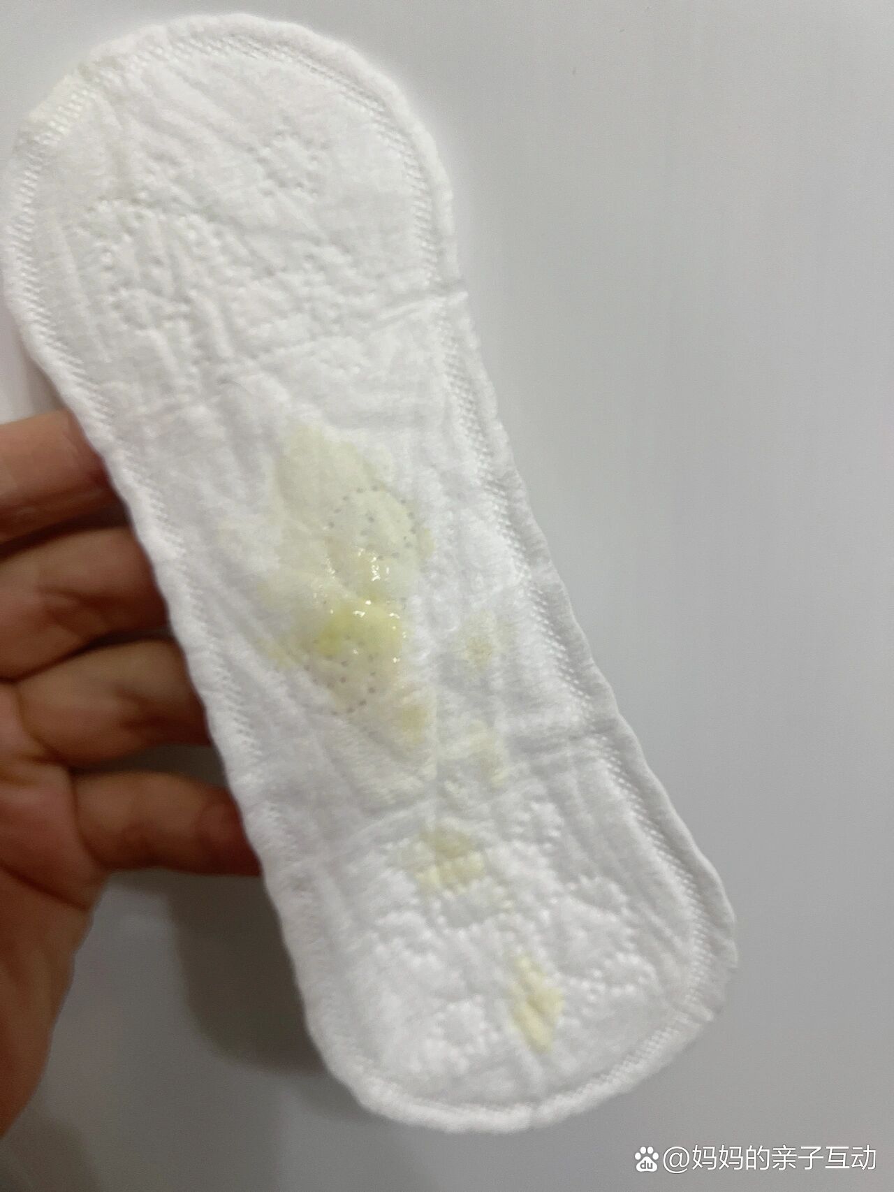 产后白带又黄又粘?