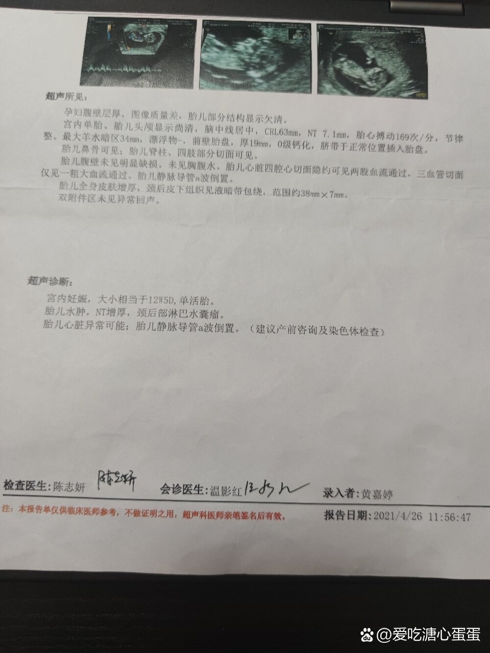 nt7.14mm,全身水肿,怎么办?