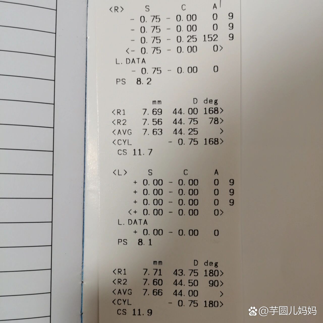 不散瞳验光结果准确吗